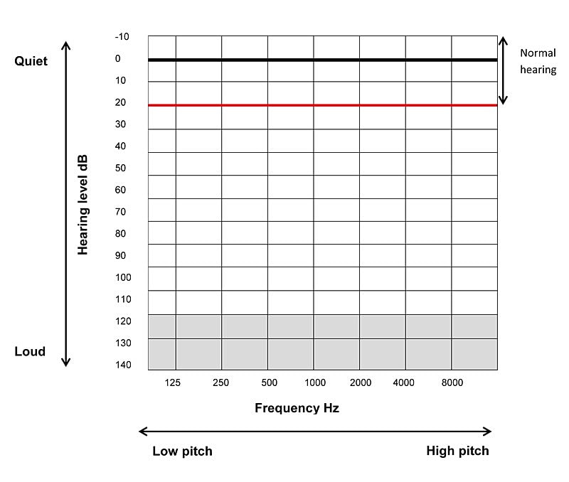 Hearing levels across frequency and loudness.